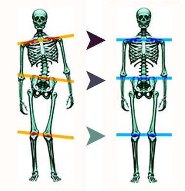 Gravitational Pattern Alignment illustration comparing skeletal alignment
